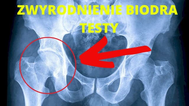 Czy biodra po porodzie się zejdą? Jak wrócić do formy i uniknąć zmian Czy biodra po porodzie się zejdą? Jak wrócić do formy i uniknąć zmian