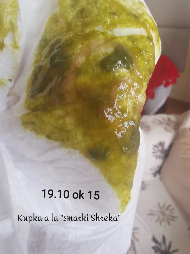 Kupy jak plastelina u niemowlaka – czy to normalne czy powód do niepokoju? Kupy jak plastelina u niemowlaka – czy to normalne czy powód do niepokoju?